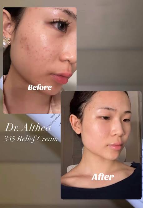 aqua dr althea افضل مرطب في الصيف